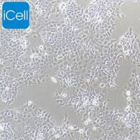 FADU、FADU细胞、FADU人咽鳞癌细胞/STR鉴定