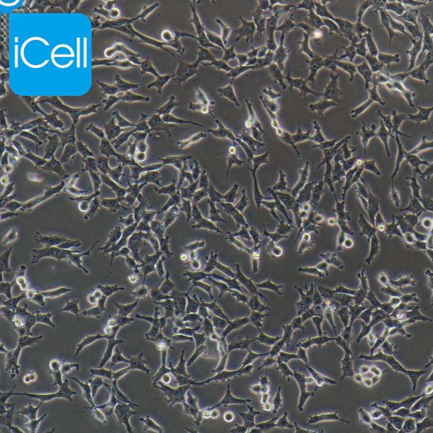 ES-2/ES-2细胞/ES2细胞/ES2/人卵巢透明细胞癌细胞/STR鉴定/镜像绮点(Cellverse)