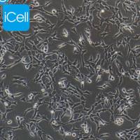 ES-2/ES-2细胞/ES2细胞/ES2/人卵巢透明细胞癌细胞/STR鉴定/镜像绮点(Cellverse)