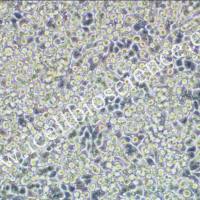 NCI-H2122细胞 | NCI-H2122 | 人非小细胞肺癌细胞 | STR鉴定