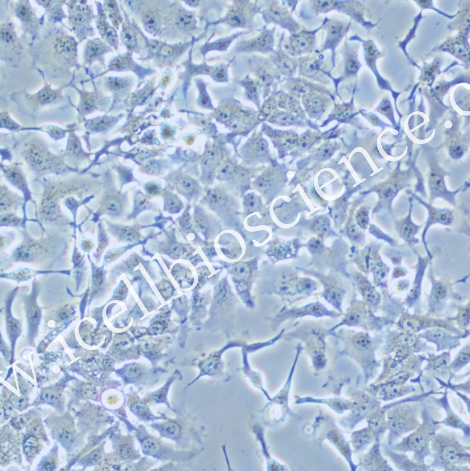 NCI-H2110/NCI-H2110细胞/人非小细胞肺癌细胞/STR鉴定/镜像绮点(Cellverse)