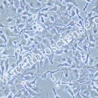 NCI-H2110/NCI-H2110细胞/人非小细胞肺癌细胞/STR鉴定/镜像绮点(Cellverse)