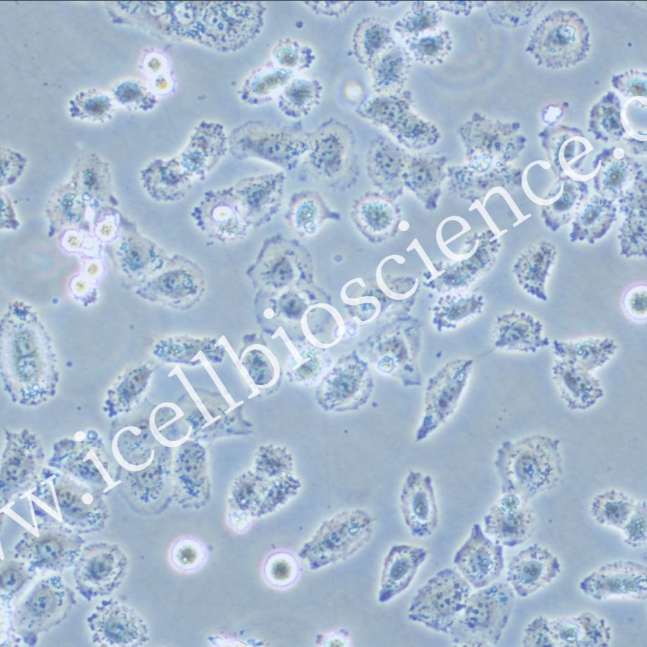 NCI-H838、NCI-H838细胞、NCI-H838细胞、NCI-H838、人肺癌细胞/STR鉴定