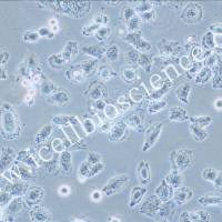 NCI-H838、NCI-H838细胞、NCI-H838细胞、NCI-H838、人肺癌细胞/STR鉴定