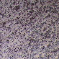 MM.1R人多发骨髓瘤细胞_MM.1R细胞(STR鉴定报告)