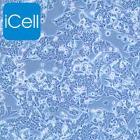 NCI-H1944 | NCI-H1944细胞 | 人肺癌细胞 | STR鉴定