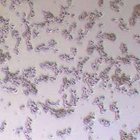 LAPC4人前列腺癌细胞_LAPC4细胞(STR鉴定报告)