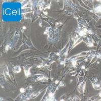 hTERT-HPNE/HPNE细胞/人胰腺导管细胞/STR鉴定/镜像绮点(Cellverse)