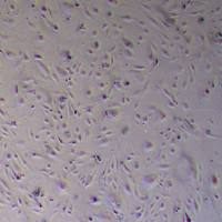 HRMEC人视网膜微血管内皮细胞(HRMEC细胞)