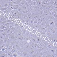 SRA01/04/SRA01/04细胞/SRA01-04细胞/SRA01-04/人晶体