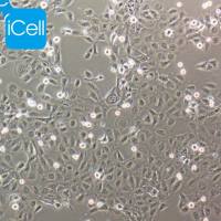 CASKI | CASKI细胞 | 人宫颈癌细胞 | STR鉴定 | 镜像绮点（Cellverse）