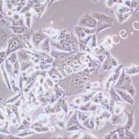 NCI-H1993细胞、NCI-H1993细胞、NCI-H1993人非小细胞肺癌腺癌细胞/STR鉴定/镜像绮点(Cellverse)