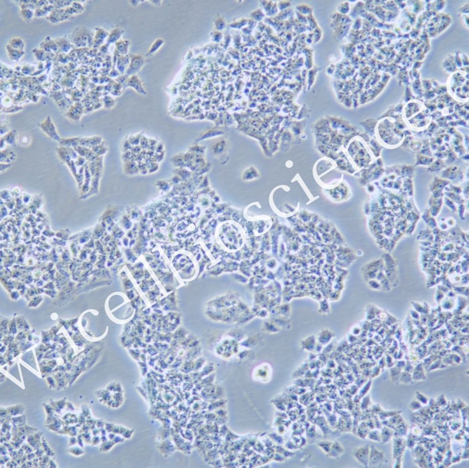 NCI-H69AR/NCI-H69AR细胞/人肺癌细胞/镜像绮点(Cellverse)