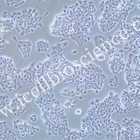 NCI-H69AR/NCI-H69AR细胞/人肺癌细胞/镜像绮点（Cellverse）