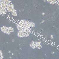 NCI-H69/NCI-H69细胞/NCI-H69细胞/人小细胞肺癌细胞/STR鉴定/镜像绮点