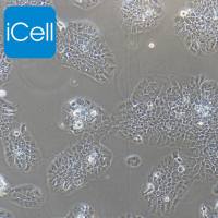 TU-212细胞 | TU212细胞 | TU-212 | TU-212 | 人喉癌细胞/STR