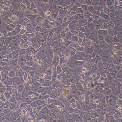 hcc1569人乳腺癌细胞_hcc1569细胞(STR鉴定报告)