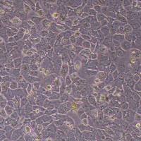 hcc1569人乳腺癌细胞_hcc1569细胞(STR鉴定报告)