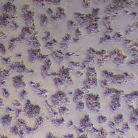 SW1463人结肠直肠腺癌细胞_SW1463细胞(STR鉴定报告)