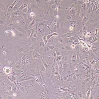 NCI-H2347人非小细胞肺癌_NCI-H2347细胞细胞(STR鉴定报告)