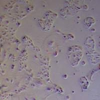 SU.86.86人胰腺导管癌细胞_SU.86.86细胞(STR鉴定报告)