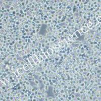 KMS-11 | KMS-11细胞 | KMS11 | KMS11细胞 | KMS-11人