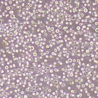 NCI-h1869人非小细胞肺癌鳞癌细胞_NCI-h1869细胞(STR鉴定报告)