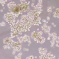 SNU-16人胃癌细胞_SNU-16细胞(STR鉴定报告)