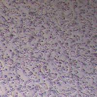 MKN-74人胃腺癌细胞_MKN-74细胞(STR鉴定)