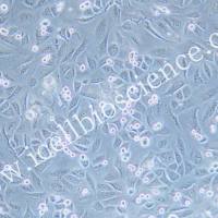 KPL-4、KPL-4细胞、KPL4细胞、KPL4、人乳腺癌细胞/STR鉴定