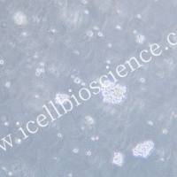 TMD8细胞 | TMD-8细胞 | TMD-8 | TMD8 | 人弥漫性大B淋巴瘤细胞 | STR鉴定