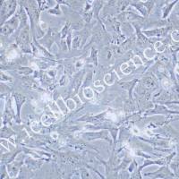 AT-3、AT-3细胞、AT3细胞、AT3、小鼠乳腺癌细胞/STR鉴定