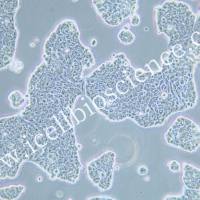 UACC-812 人乳腺导管癌细胞/STR鉴定/镜像绮点(Cellverse)