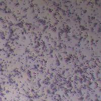 D341Med人脑髓母细胞瘤细胞_D341Med细胞(STR鉴定报告)