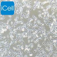 WM-115、WM-115细胞、WM115细胞、WM115、人恶性黑色素瘤细胞/STR鉴定/镜像绮点（Cellverse）