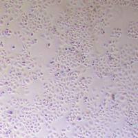 NCI-H522人肺癌细胞_NCI-H522细胞(STR鉴定报告)