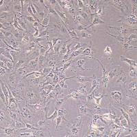 PA-1人卵巢畸胎瘤细胞_PA-1细胞(STR鉴定报告)
