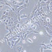 HT-3、HT-3细胞、HT3细胞、HT3、人子宫颈癌细胞/STR鉴定/镜像绮点(Cellverse)