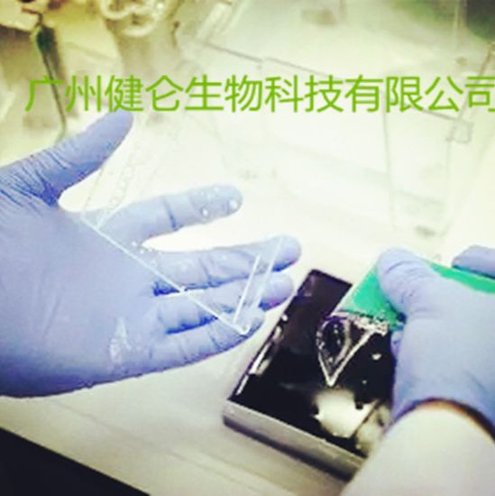 腺病毒IgM抗体检测试剂盒（IFA法）说明书