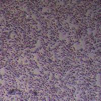 92-1人葡萄膜黑色素瘤_92-1细胞(STR鉴定报告)