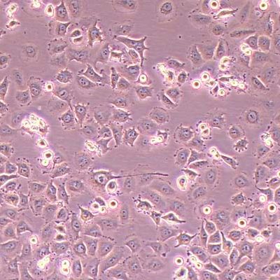 OVCAR-5人转移性胃肠癌细胞_OVCAR-5细胞(STR鉴定报告)