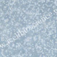 SU-DHL-8 | SU-DHL-8细胞 | SUDHL8细胞 | SUDHL8 | 人B细胞淋巴瘤细胞 | STR鉴定