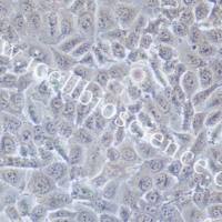 MV3、MV3细胞、MV-3细胞、MV-3、人黑色素瘤细胞/STR鉴定