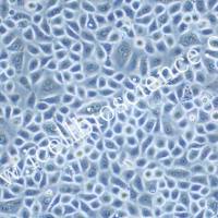 VK2/E6E7细胞、VK2-E6E7细胞、VK2/E6E7、VK2-E6E7、人阴道上皮细胞/STR鉴定/镜像绮点（Cellverse）