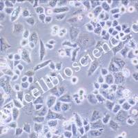 MX-1 | MX-1细胞 | MX1细胞 | MX1 | 人乳腺癌细胞 | STR鉴定