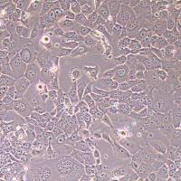 HT-3人子宫颈癌细胞_HT-3细胞(STR鉴定报告)