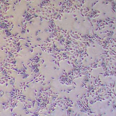 Panc08.13人胰腺癌细胞_Panc08.13细胞(STR鉴定报告)