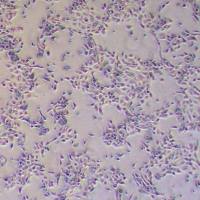 Panc08.13人胰腺癌细胞_Panc08.13细胞(STR鉴定报告)