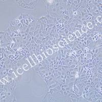 OAW-28 |OAW-28细胞|OAW28|OAW28细胞|OAW-28人卵巢上皮性肿瘤细胞/免费送STR鉴定