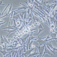 SK-MEL-5 人皮肤恶性黑色素瘤细胞/STR鉴定/镜像绮点（Cellverse）